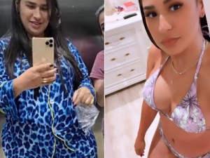 Cantora Simone posa de biquíni para mostrar resultado de abdominoplastia