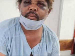 'Não fiz nenhum mal', diz morador de rua agredido por personal que flagrou sexo com mulher, no DF