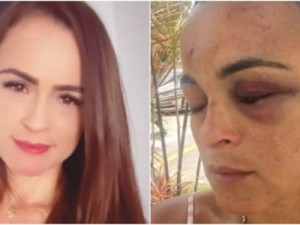 Corretora é agredida e denuncia companheiro por tentativa de feminicídio em Fortaleza