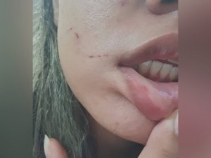 Segunda jovem afirma ter sido agredida por médico no Ceará: 'Disse que iria me matar'