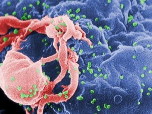 Como surgiu o vírus HIV, causador da aids? Entenda a história da doença