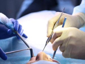 Adolescente sofre necrose nos dentes após aplicar lentes com mulher que não é dentista em SP