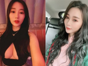 Modelo morre ao receber polêmica 'injeção de leite' para tratar insônia crônica