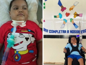 Criança picada 5 vezes por escorpião no DF tem piora no quadro; família busca novos tratamentos