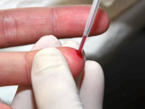 Brasil vive alta nos casos de hepatite A após uma década de queda