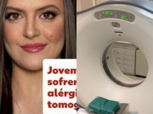 Jovem morre após sofrer reação alérgica durante tomografia com contraste em SC