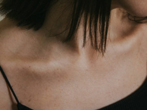 Mulheres com ciclo menstrual irregular têm mais problemas de pele, aponta estudo