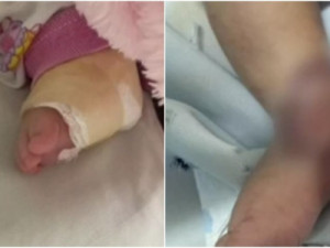 Bebê tem ferimento grave após injeção em hospital no Ceará; família cita negligência