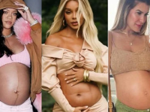 Famosas compartilham experiências: por que a celulite aparece mais após a gestação