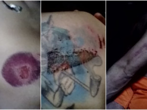 Familiares denunciam agressões e tortura de detentos em presídio no Ceará