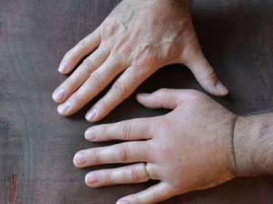 Angioedema: o que é, sintomas, causas, tipos e tratamento