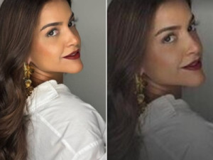 Mulher entra em estado vegetativo após cirurgia de baixo risco e família denuncia negli-gência em hospital particular no Recife