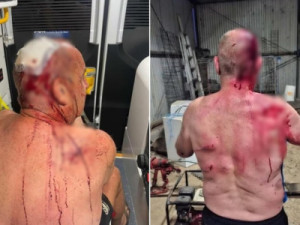 Aposentado tenta salvar cão, mas é brutalmente atacado por canguru