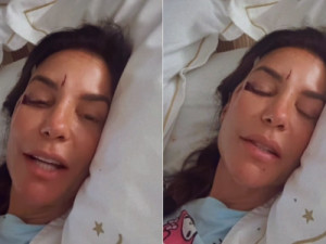 Especialista explica desmaio de Ivete Sangalo após desidratação; entenda