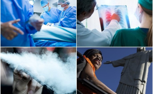 Conheça os dois hábitos que mais geram casos de câncer no mundo e como podem ser evitados