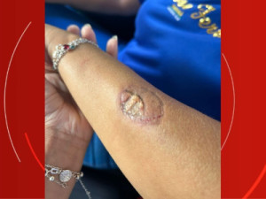 Mãe de aluno agride funcionárias e morde vice-diretora dentro de escola no Paraná