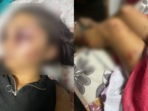 Namorado suspeito de agredir e sequestrar adolescente de 17 anos é encontrado morto no Ceará