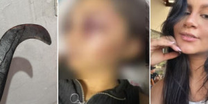 De mão decepada a adolescente morta: em uma semana, Ceará teve três casos extremos de violência contra mulher