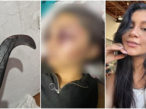 De mão decepada a adolescente morta: em uma semana, Ceará teve três casos extremos de violência contra mulher