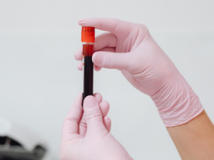 Incidência entre os homens com leucemia é 20% maior do que entre as mulheres