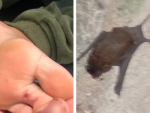 Criança é mordida por morcego escondido dentro de sapato e recebe soro antirrábico