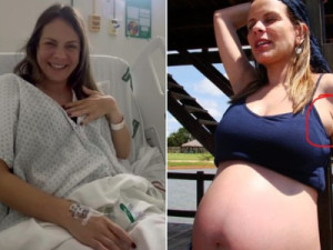 Mãe relata caso raro ao notar leite saindo das axilas durante a gravidez: "Fui sorteada"