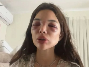 Dentista é agredida por empresário da Faria Lima; vítima relata episódio: 'tentou me matar'