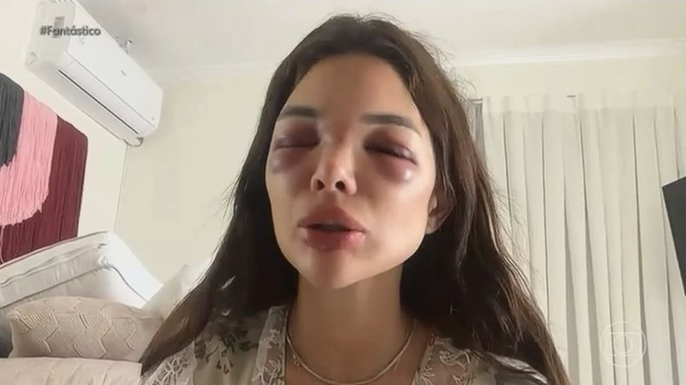 Dentista é agredida por empresário da Faria Lima; vítima relata episódio: 'tentou me matar'