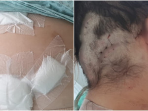 Mulher é mantida em cárcere, torturada e atingida pelo ex com 12 facadas: 'fingi que estava morta'